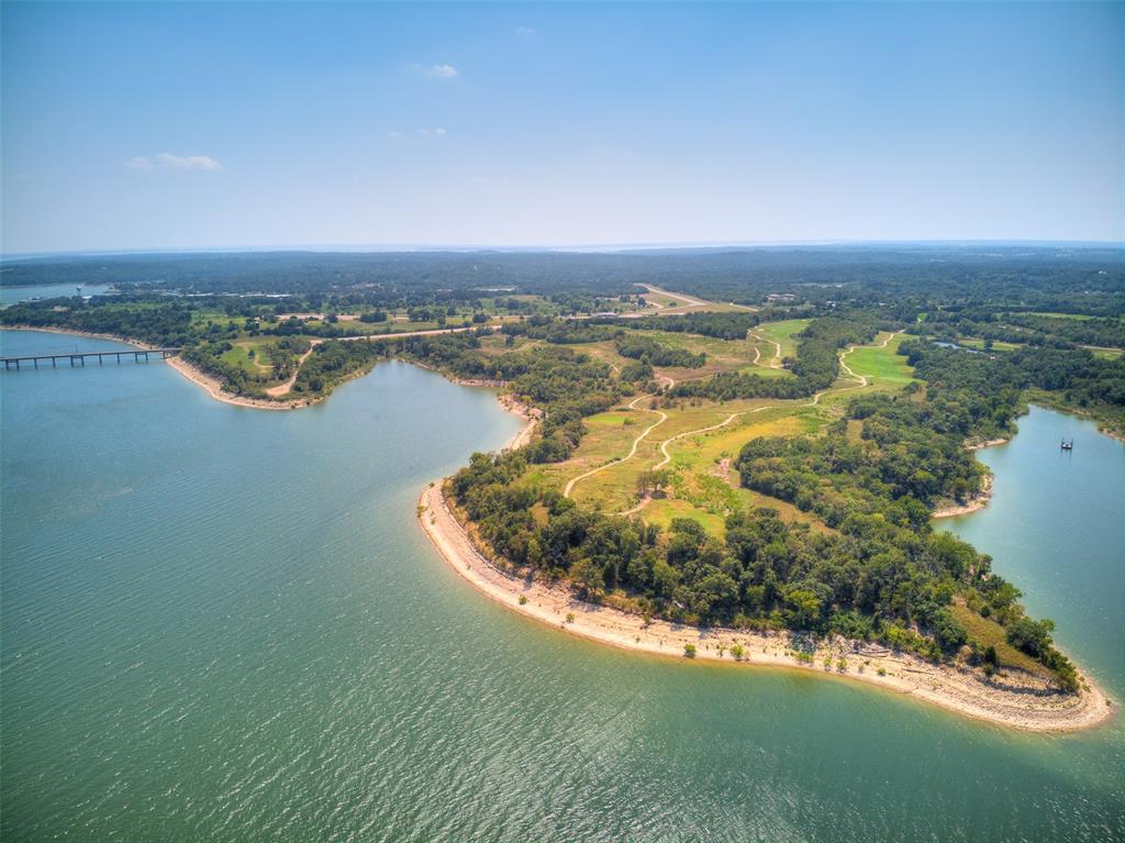 listing main picture