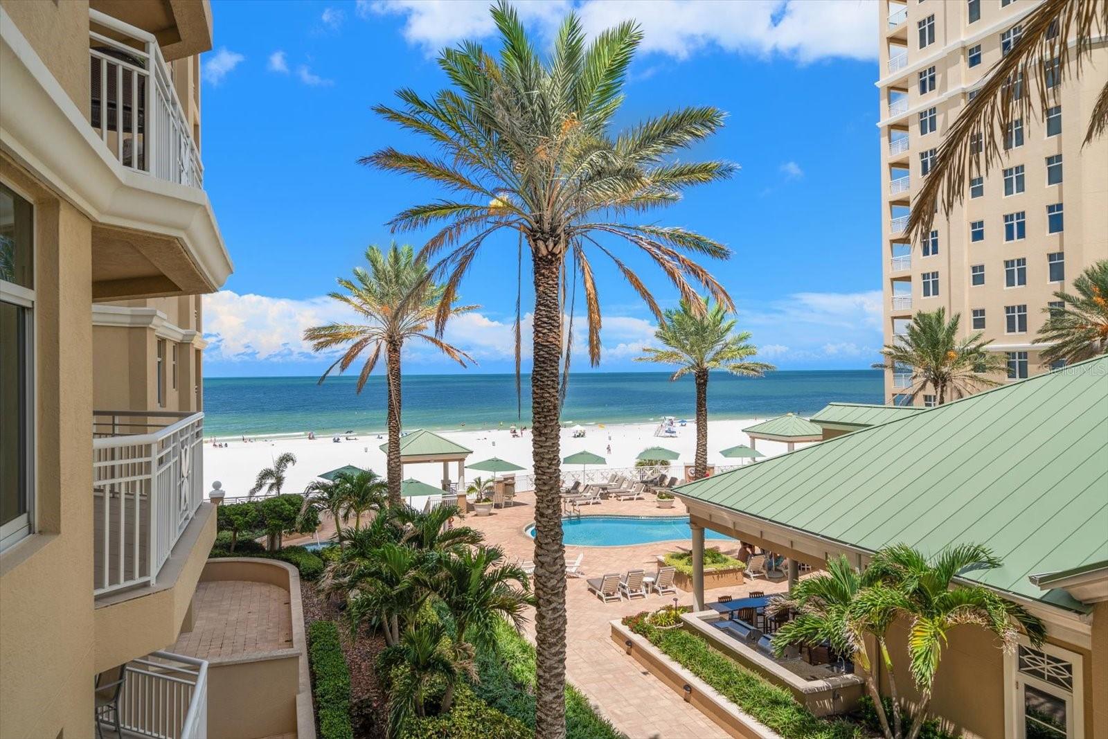 listing main picture