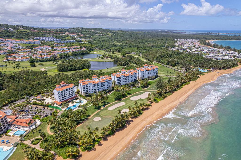 listing main picture